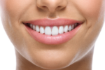 how to naturally whiten your teeth at home