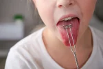 Child sticking out their tongue during an oral assessment with a dental instrument