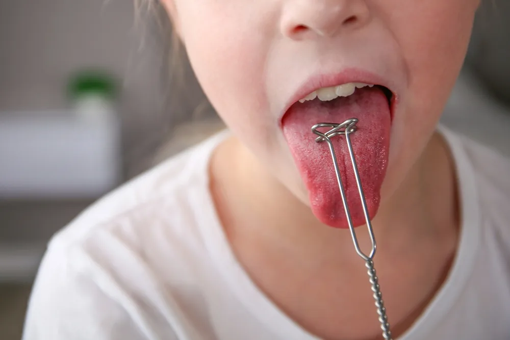 Child sticking out their tongue during an oral assessment with a dental instrument