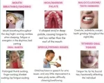 signs your child may need myofunctional therapy