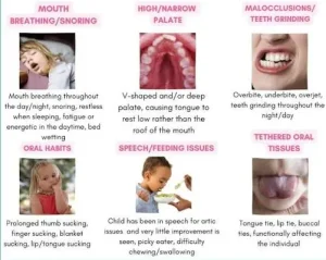 signs your child may need myofunctional therapy