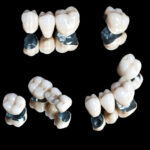 Understanding the basics of restorative dentistry